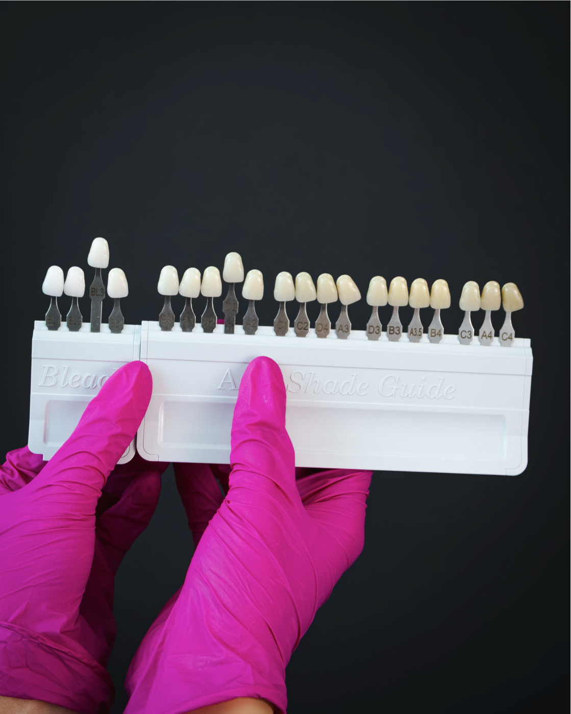 Blanqueamiento dental Blanc & Co imagen 5