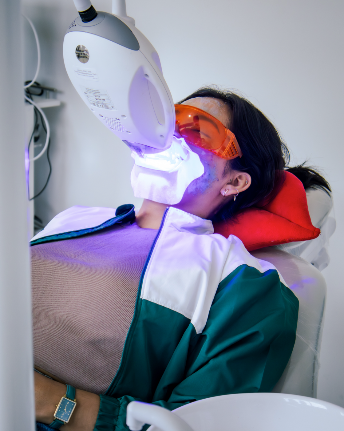 Blanqueamiento dental Blanc & Co imagen 8